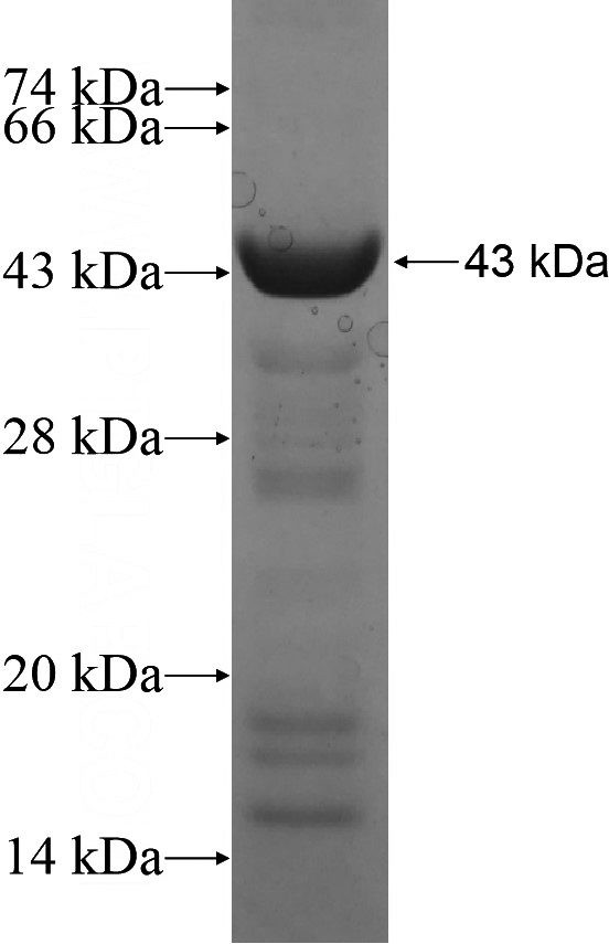 Recombinant Human GALNS SDS-PAGE