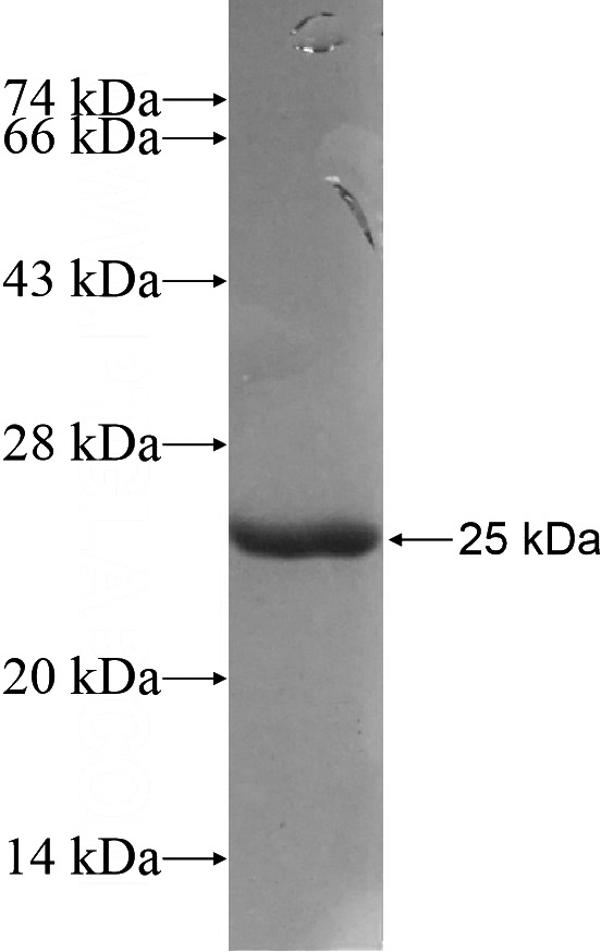 Recombinant Human CUL1 SDS-PAGE