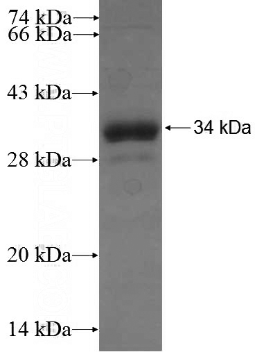 Recombinant Human KLF6 SDS-PAGE