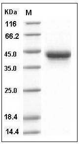 Human IL2Ra / CD25 Protein (His Tag) SDS-PAGE