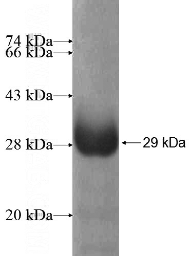 Recombinant Human NAT11 SDS-PAGE
