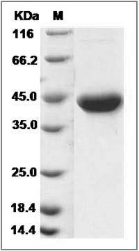 Human Galanin / GAL Protein (Fc Tag) SDS-PAGE