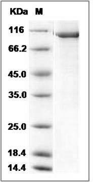 Human PFK1 / PFKM Protein (His & GST Tag) SDS-PAGE