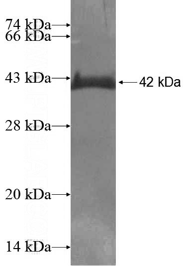 Recombinant Human PSMD5 SDS-PAGE