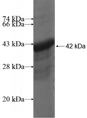 Recombinant Human HKR1 SDS-PAGE