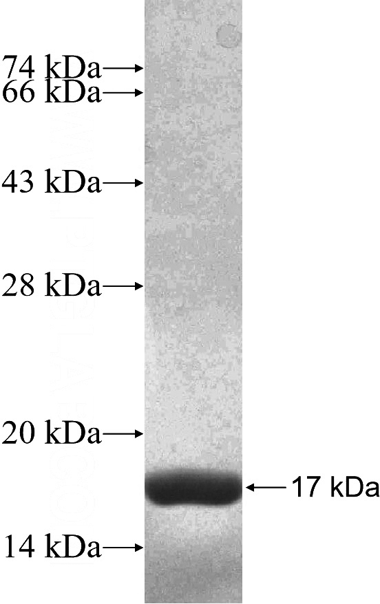 Recombinant Human NOS2 SDS-PAGE