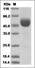 Human PRND / Prion protein 2 Protein (Fc Tag) SDS-PAGE