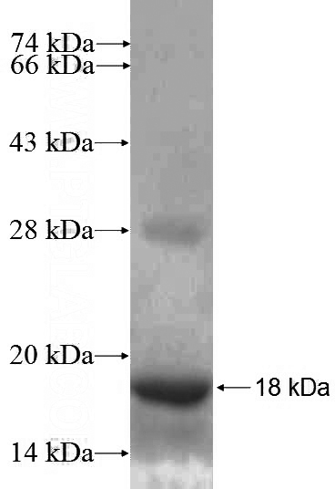 Recombinant Human SHANK2 SDS-PAGE