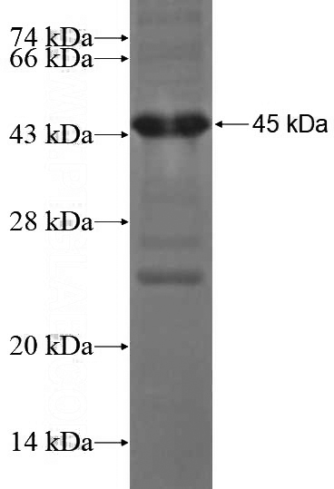 Recombinant Human PHF17 SDS-PAGE