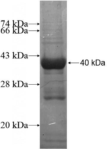 Recombinant Human ANAPC1 SDS-PAGE