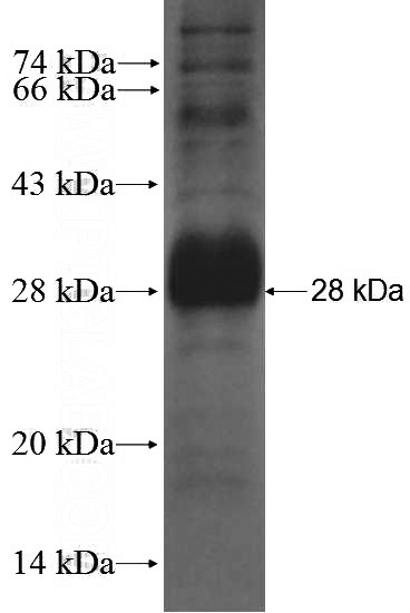 Recombinant Human CRB2 SDS-PAGE