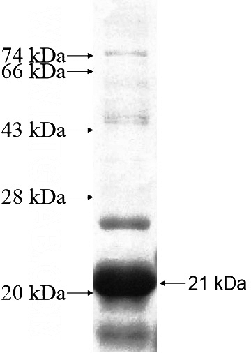 Recombinant Human LATS1 SDS-PAGE