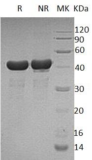 Human PPID/CYP40/CYPD (His tag) recombinant protein