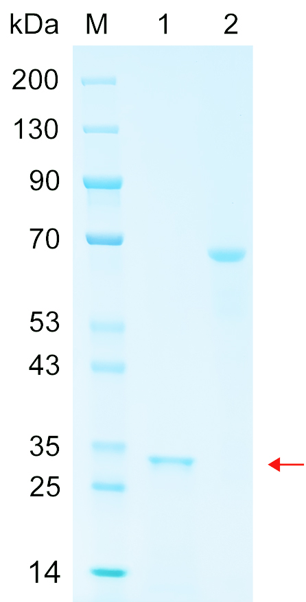 Recombinant UBE2O protein (His tag) SDS-PAGE
