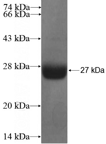 Recombinant Human RGS4 SDS-PAGE