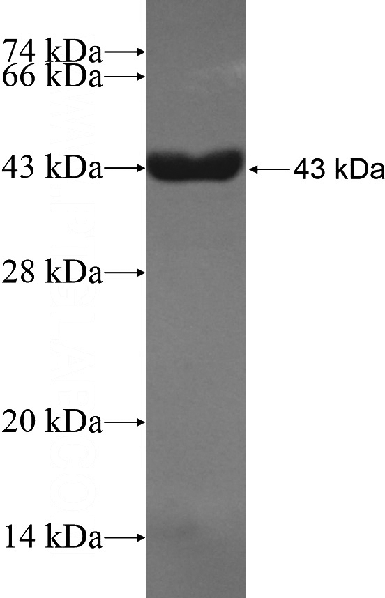 Recombinant Human ARMC3 SDS-PAGE