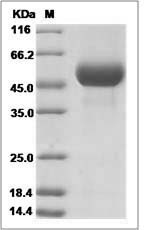 Influenza A H5N8 Protein (A/duck/Zhejiang/W24/2013) Hemagglutinin / HA1 Protein (His Tag)