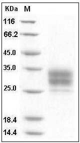 Mouse CD16-2 / FCGR4 Protein (His Tag) SDS-PAGE