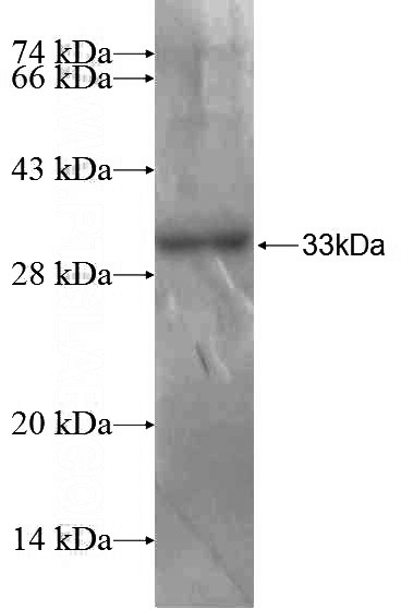 Recombinant Human JAK3 SDS-PAGE