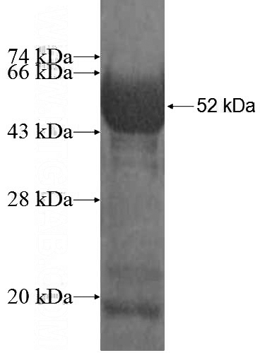 Recombinant Human WAPL; WAPAL SDS-PAGE