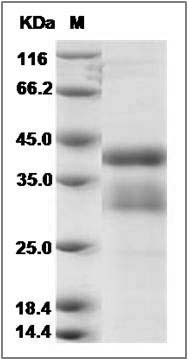 Human R-Spondin 1 / RSPO1 Protein SDS-PAGE