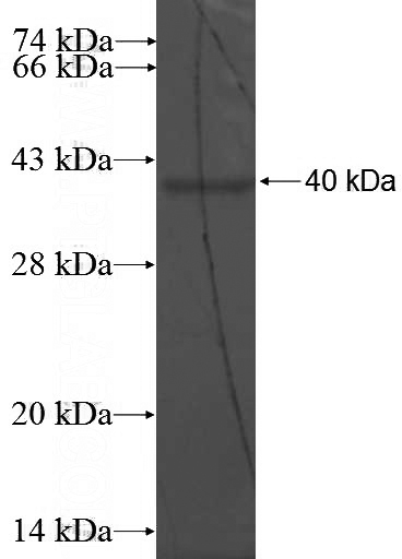 Recombinant Human NLRP9 SDS-PAGE
