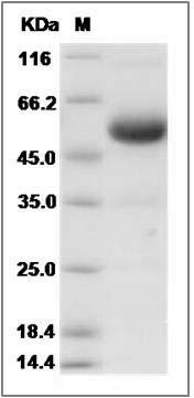 Rat CD40 / TNFRSF5 Protein (Fc Tag) SDS-PAGE