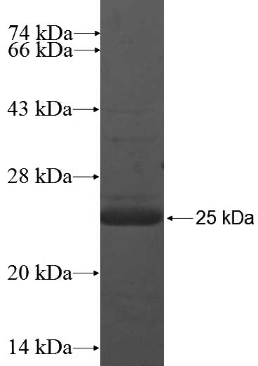 Recombinant Human C6orf108 SDS-PAGE