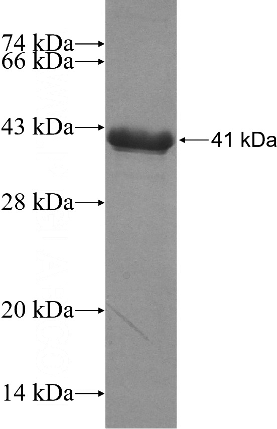 Recombinant Human GRIP1 SDS-PAGE