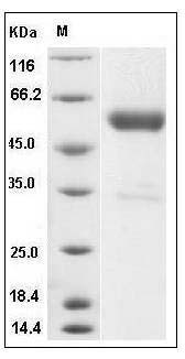 Mouse IFNB1 / IFN-beta / Interferon beta Protein (Fc Tag) SDS-PAGE