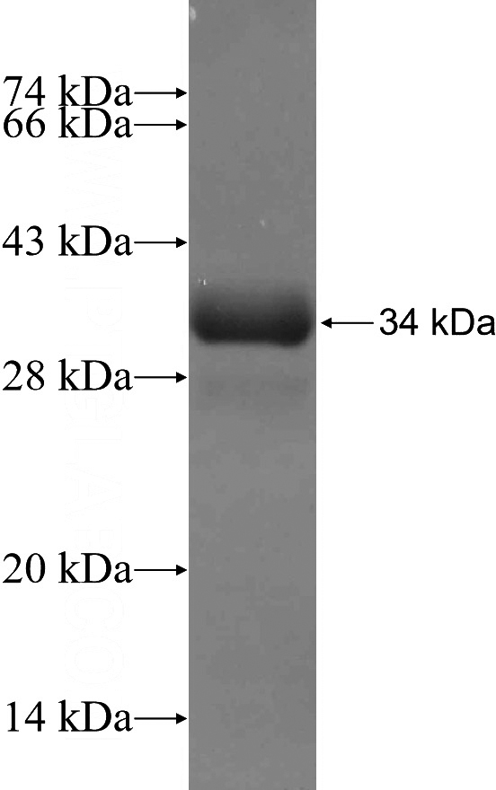 Recombinant Human SLC6A3 SDS-PAGE