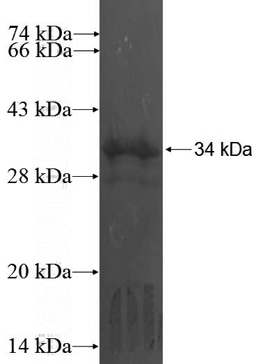 Recombinant Human PIM2 SDS-PAGE