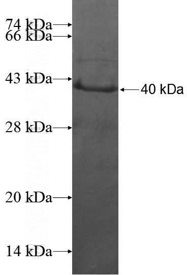 Recombinant Human BUB3 SDS-PAGE