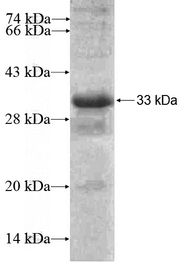 Recombinant Human ULK2 SDS-PAGE