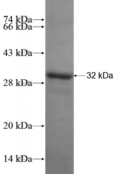 Recombinant Human NOX1 SDS-PAGE
