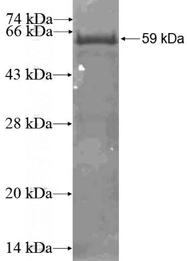 Recombinant Human RBM15 SDS-PAGE