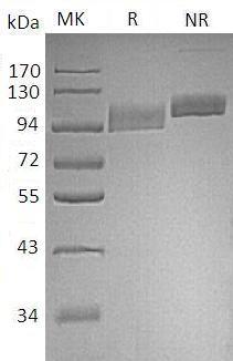 Human MME/EPN (His tag) recombinant protein