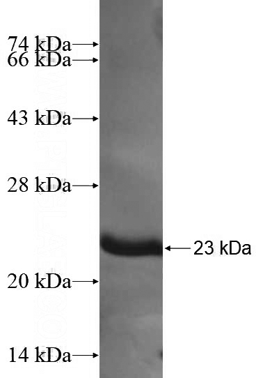 Recombinant Human MARCH8 SDS-PAGE