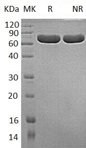 Human ALPP/PLAP (His tag) recombinant protein