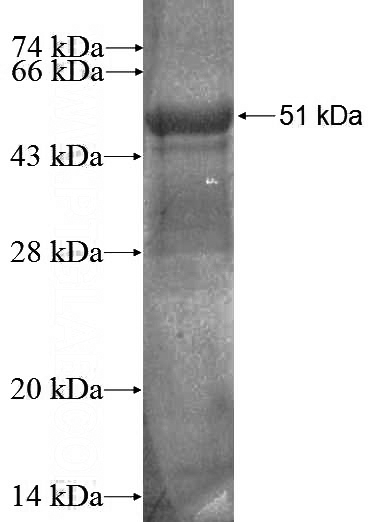 Recombinant Human RGS19 SDS-PAGE
