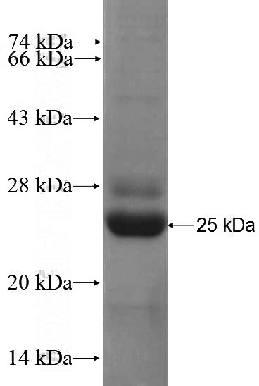 Recombinant Mouse Cd68 SDS-PAGE
