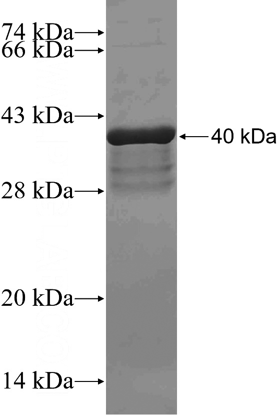 Recombinant Human EPB41L5 SDS-PAGE