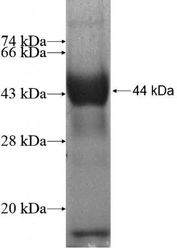 Recombinant Human SLC9A10 SDS-PAGE