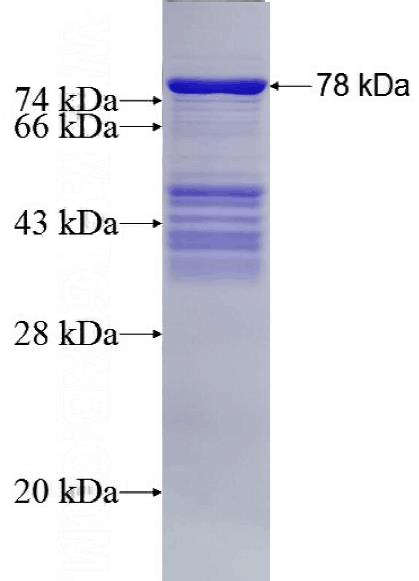 Recombinant Human MCRS1 SDS-PAGE