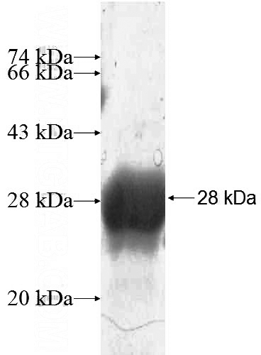Recombinant Human ETV4 SDS-PAGE