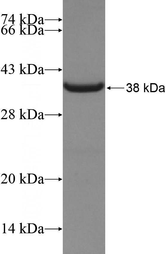 Recombinant Human KIF17 SDS-PAGE