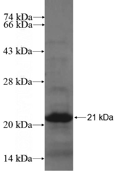 Recombinant Human HSD17B1 SDS-PAGE