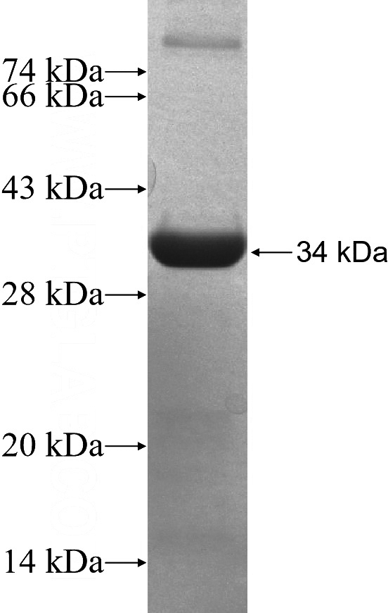 Recombinant Human STX17 SDS-PAGE