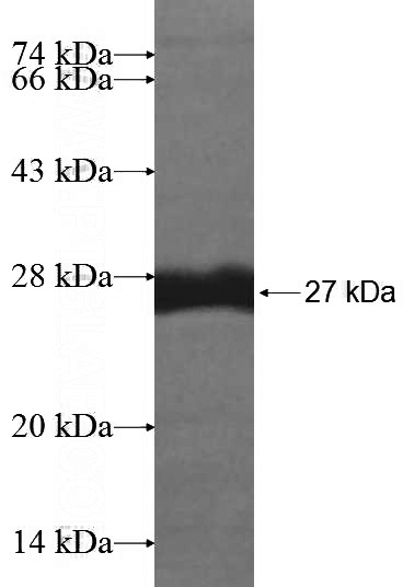 Recombinant Human RD3 SDS-PAGE