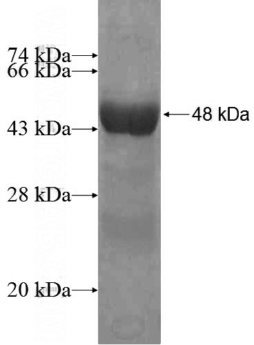 Recombinant Human ARL14 SDS-PAGE